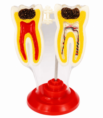 Modelo Anatómico Dental Acrílico